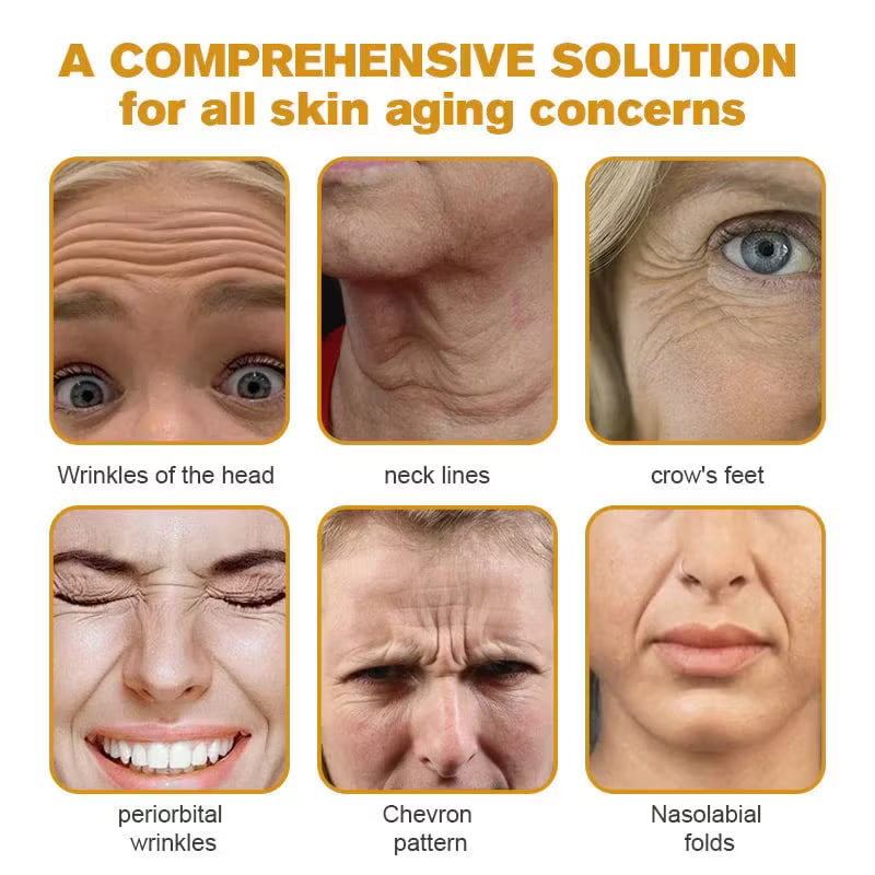 Botox Bee Venom Wrinkle Removal Cream